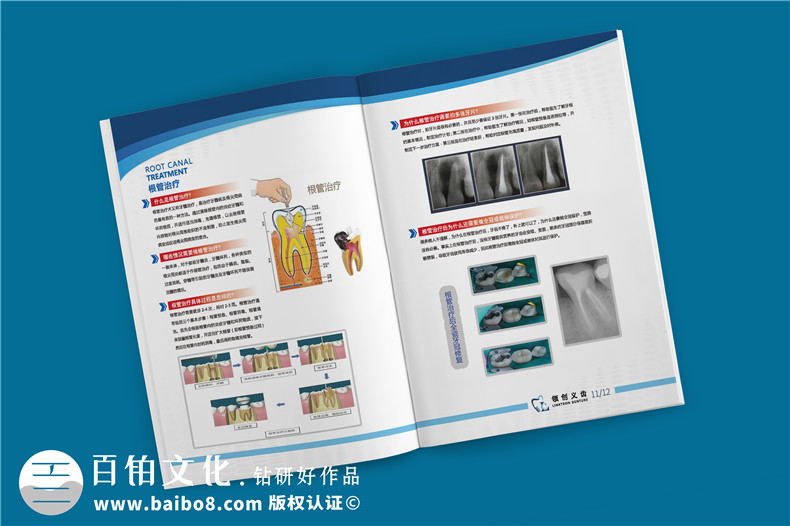 義齒產品宣傳手冊-義齒廠家圖冊假牙制造口腔修復公司畫冊設計